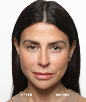 Olcay Gulsen Beauty Instant Eye Tightener