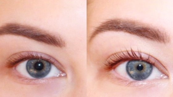 Eyelash lift