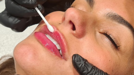 Collageen Lip Treatment Cure